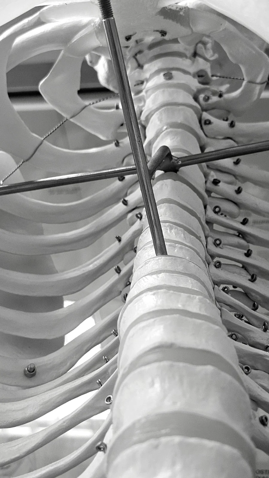 Spinal rod and screw construct fitted to an anatomical spine model